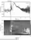Fig. 20 - EMBEDDED SEIZURE DETECTION DURING THERAPEUTIC BRAIN STIMULATION