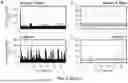 Fig. 23 - EMBEDDED SEIZURE DETECTION DURING THERAPEUTIC BRAIN STIMULATION