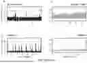 Fig. 35 - EMBEDDED SEIZURE DETECTION DURING THERAPEUTIC BRAIN STIMULATION