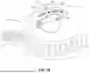 Fig. 03 - PREVENTING CAPACITOR REVERSE BIASING DURING DISCHARGE IN MEDICAL DEVICE