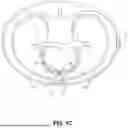 Fig. 04 - PREVENTING CAPACITOR REVERSE BIASING DURING DISCHARGE IN MEDICAL DEVICE