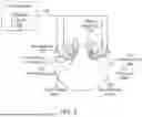 Fig. 04 - METHODS, DEVICES, AND SYSTEMS FOR NON-INVASIVE PREVENTION AND TREATMENT OF PREMATURE EJACULATION