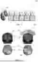 Fig. 02 - MULTI-LOCUS TRANSCRANIAL MAGNETIC STIMULATION TRANSDUCER