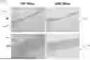 Fig. 01 - DEVICES AND METHODS FOR TREATMENTS USING MICROWAVE ENERGY