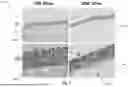 Fig. 03 - DEVICES AND METHODS FOR TREATMENTS USING MICROWAVE ENERGY
