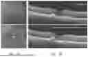Fig. 16 - METHODS FOR TREATING OCULAR DISEASE