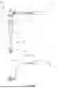 Fig. 02 - SUSPENSION DAMPING FOR A VEHICLE