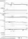 Fig. 05 - ROLLOVER DETECTION METHOD AND VEHICLE