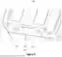 Fig. 06 - Tool Container System