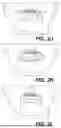 Fig. 06 - SYSTEMS FOR UPPER LIP LIFT PROCEDURES AND METHODS OF THEIR USE