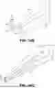 Fig. 16 - SYSTEMS FOR UPPER LIP LIFT PROCEDURES AND METHODS OF THEIR USE