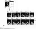 Fig. 09 - Visual Prompt Tuning for Generative Transfer Learning