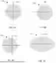Fig. 04 - FAST MOTION-RESOLVED MRI RECONSTRUCTION USING SPACE-TIME-COIL CONVOLUTIONAL NETWORKS WITHOUT K-SPACE DATA CONSISTENCY