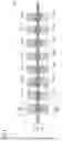 Fig. 04 - COIL DEVICE