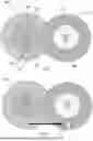 Fig. 02 - RADIO FREQUENCY DEVICES