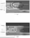 Fig. 02 - LIGHT-EMITTING SUBSTRATE AND BACKLIGHT MODULE