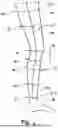 Fig. 07 - COMPRESSION GARMENT WITH MULTIPLE COMPRESSION FORCES AND METHOD FOR FORMING THE SAME