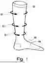 Fig. 09 - COMPRESSION GARMENT WITH MULTIPLE COMPRESSION FORCES AND METHOD FOR FORMING THE SAME