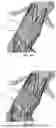 Fig. 07 - METHOD FOR MODELLING AN ENDOPROTHESIS IMPLANTED IN A PORTION OF A PATIENT AORTA