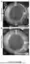 Fig. 06 - FABRICATED ENGINEERED SKIN DERMIS COMPOSITIONS AND METHODS THEREOF