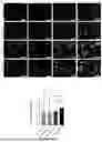 Fig. 16 - FABRICATED ENGINEERED SKIN DERMIS COMPOSITIONS AND METHODS THEREOF