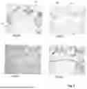 Fig. 07 - WOUND CONTACTING MEMBERS AND METHODS