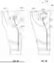 Fig. 08 - URINARY CATHETER SYSTEMS AND METHODS