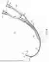 Fig. 09 - Multi-Lumen Vascular Access Device and Related Methods