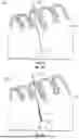 Fig. 02 - AGENT DELIVERY CATHETER