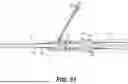 Fig. 33 - LEAD SCREW DRIVEN SHEATH DILATOR