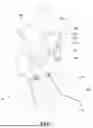 Fig. 09 - METHOD OF REDUCING MICROVASCULAR OBSTRUCTIONS BY PROVIDING VENTRICULAR SUPPORT