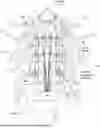 Fig. 01 - METHODS AND SYSTEMS FOR IMPLANTING A NEUROMODULATION SYSTEM AT A SURGICALLY OPEN SPINAL TREATMENT SITE