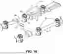 Fig. 16 - METHODS AND SYSTEMS FOR IMPLANTING A NEUROMODULATION SYSTEM AT A SURGICALLY OPEN SPINAL TREATMENT SITE