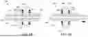 Fig. 06 - SYSTEMS AND METHODS FOR IMPLANTABLE MEDICAL DEVICE ANCHORS