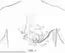Fig. 02 - PERICARDIAL LEAD