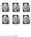 Fig. 07 - AUTOMATIC COMPUTER-IMPLEMENTED DETECTION OF SPOT DEFORMATION