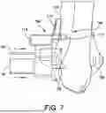 Fig. 08 - SYSTEMS AND METHODS FOR INSTALLING AN ORTHOPEDIC IMPLANT