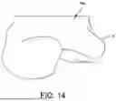 Fig. 13 - SYSTEMS AND METHODS FOR INSTALLING AN ORTHOPEDIC IMPLANT