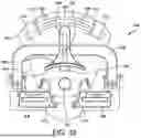 Fig. 30 - SYSTEMS AND METHODS FOR INSTALLING AN ORTHOPEDIC IMPLANT