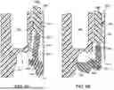 Fig. 52 - SYSTEMS AND METHODS FOR INSTALLING AN ORTHOPEDIC IMPLANT