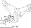 Fig. 62 - SYSTEMS AND METHODS FOR INSTALLING AN ORTHOPEDIC IMPLANT