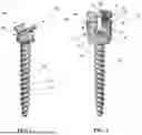 Fig. 02 - MODULAR TULIP FOR USE WITH ORTHOPEDIC SCREW