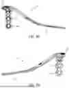 Fig. 05 - LATERAL PROXIMAL TIBIA PLATE WITH EXTENSION ARM