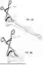 Fig. 07 - LATERAL PROXIMAL TIBIA PLATE WITH EXTENSION ARM