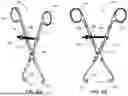 Fig. 09 - LATERAL PROXIMAL TIBIA PLATE WITH EXTENSION ARM