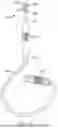 Fig. 07 - SOFT PALATE TREATMENT