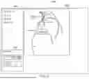 Fig. 09 - PROCEDURE INFORMATION OVERLAY OVER ANGIOGRAPHY DATA