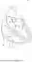 Fig. 02 - SELF-GROWING HEART VALVES