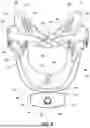 Fig. 09 - CERVICAL COLLAR