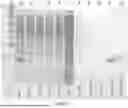 Fig. 02 - Nutritive Polypeptides and Formulations Thereof, and Methods of Production and Use Thereof